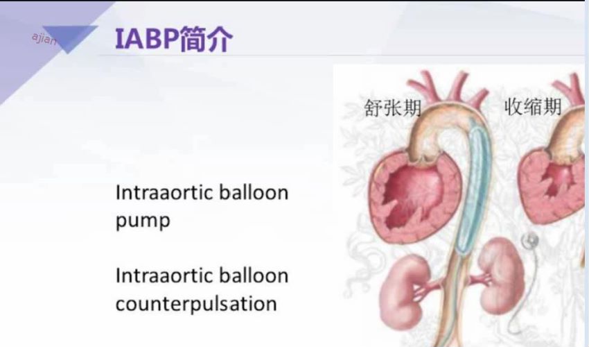 丁香园：急性心衰的规范及治疗，网盘下载(588.37M)