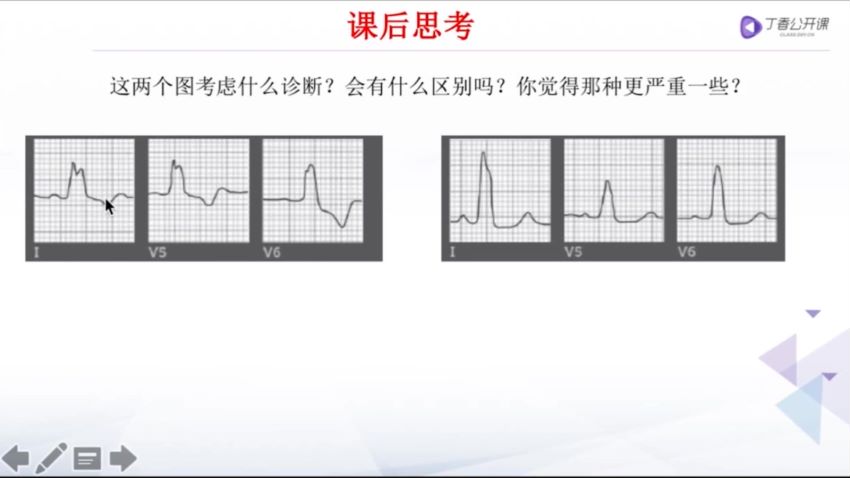 丁香园：危急重症心电图198元，网盘下载(2.15G)